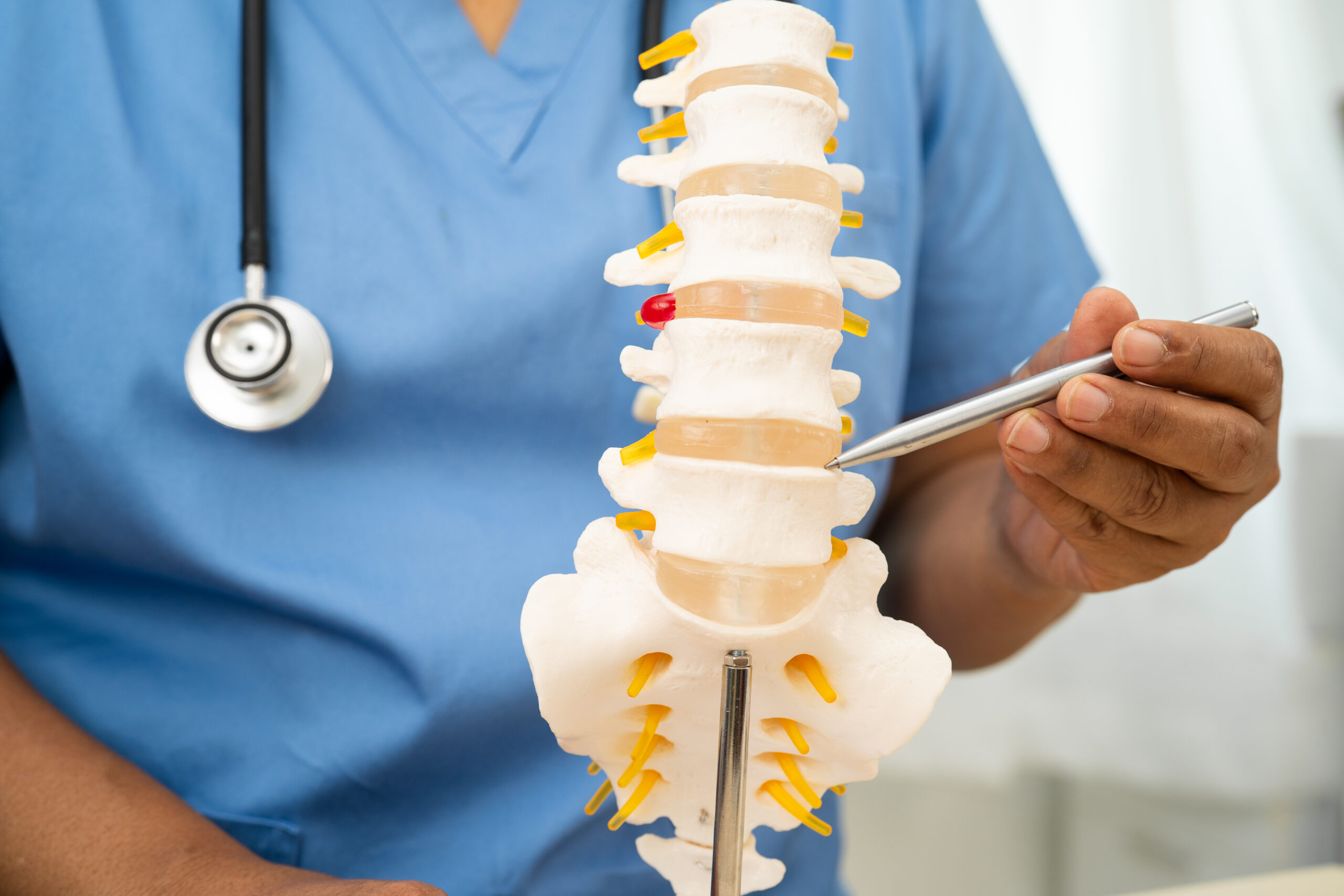 Herniated Nucleus Pulposus (HNP) – Symptoms, Causes  and Prevention